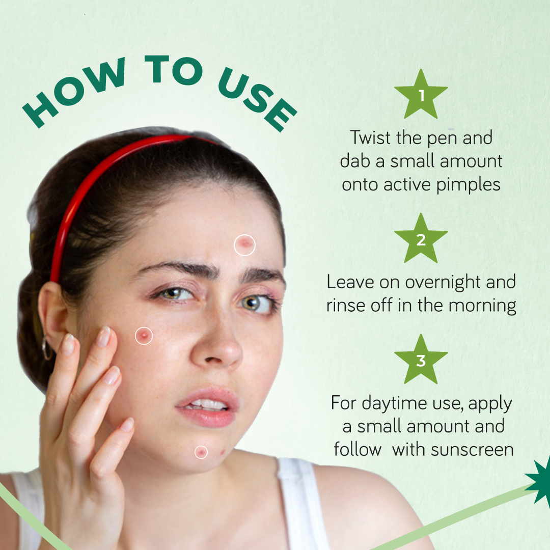Acnexpert Overnight Spot Correcting Pen with Salicylic Acid and Green Tea