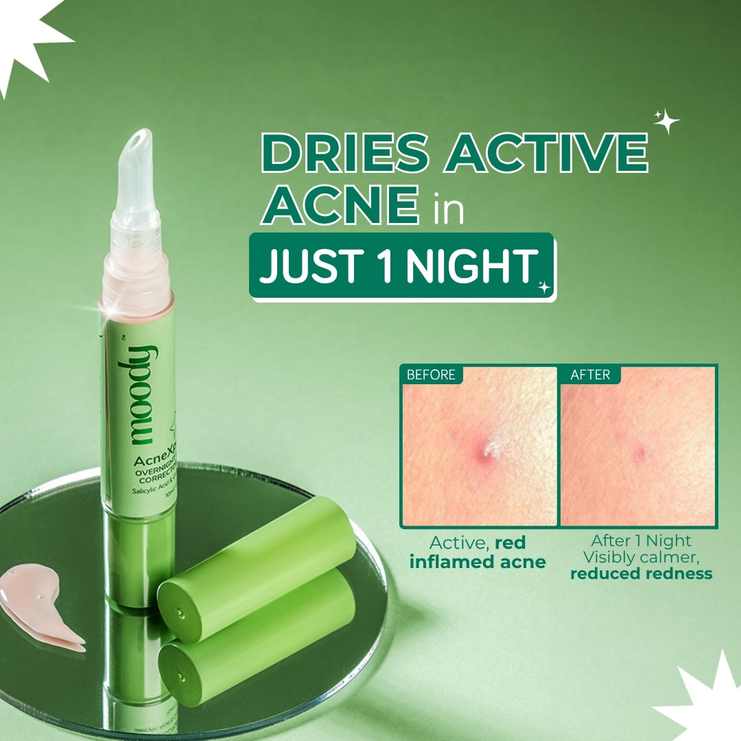 Acnexpert Overnight Spot Correcting Pen with Salicylic Acid and Green Tea