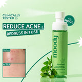 AcneXpert Skin Clarifying Face Mist With Green Tea & Niacinamide