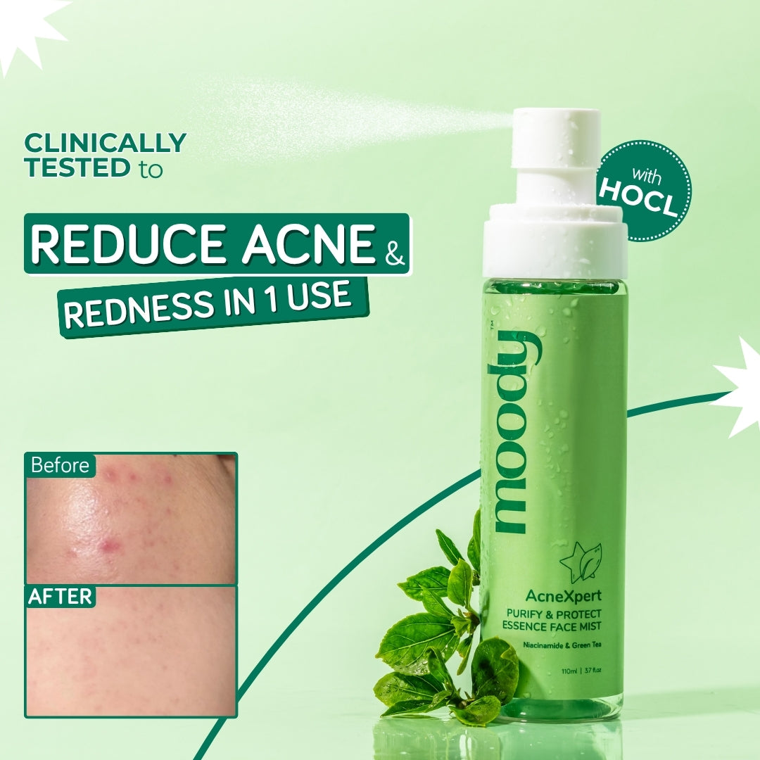 AcneXpert Skin Clarifying Face Mist With Green Tea & Niacinamide