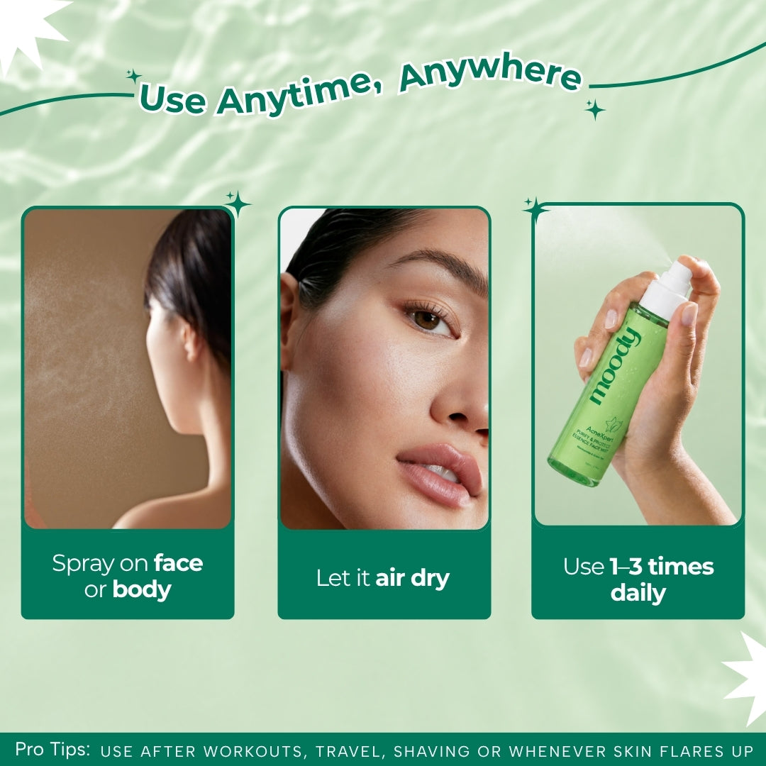 AcneXpert Skin Clarifying Face Mist With Green Tea & Niacinamide