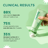 AcneXpert Oil Control Clay Mask with Salicylic Acid & Green Tea