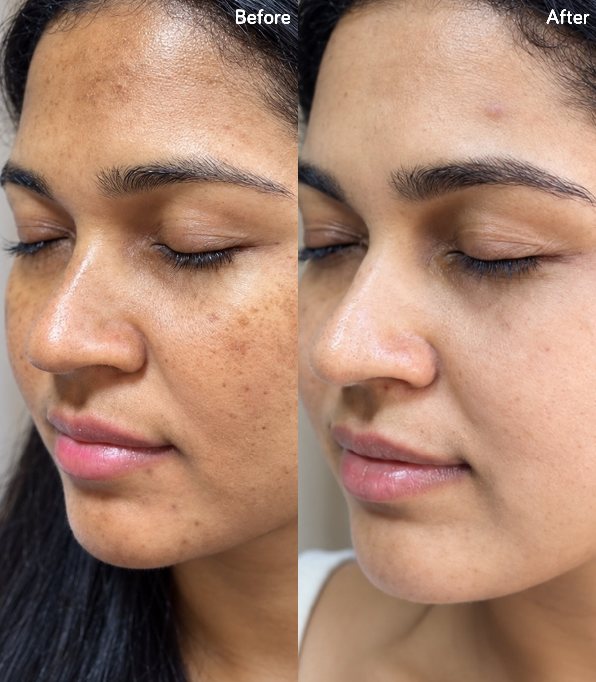 Before and After Results