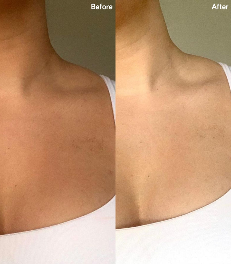Before and After Results