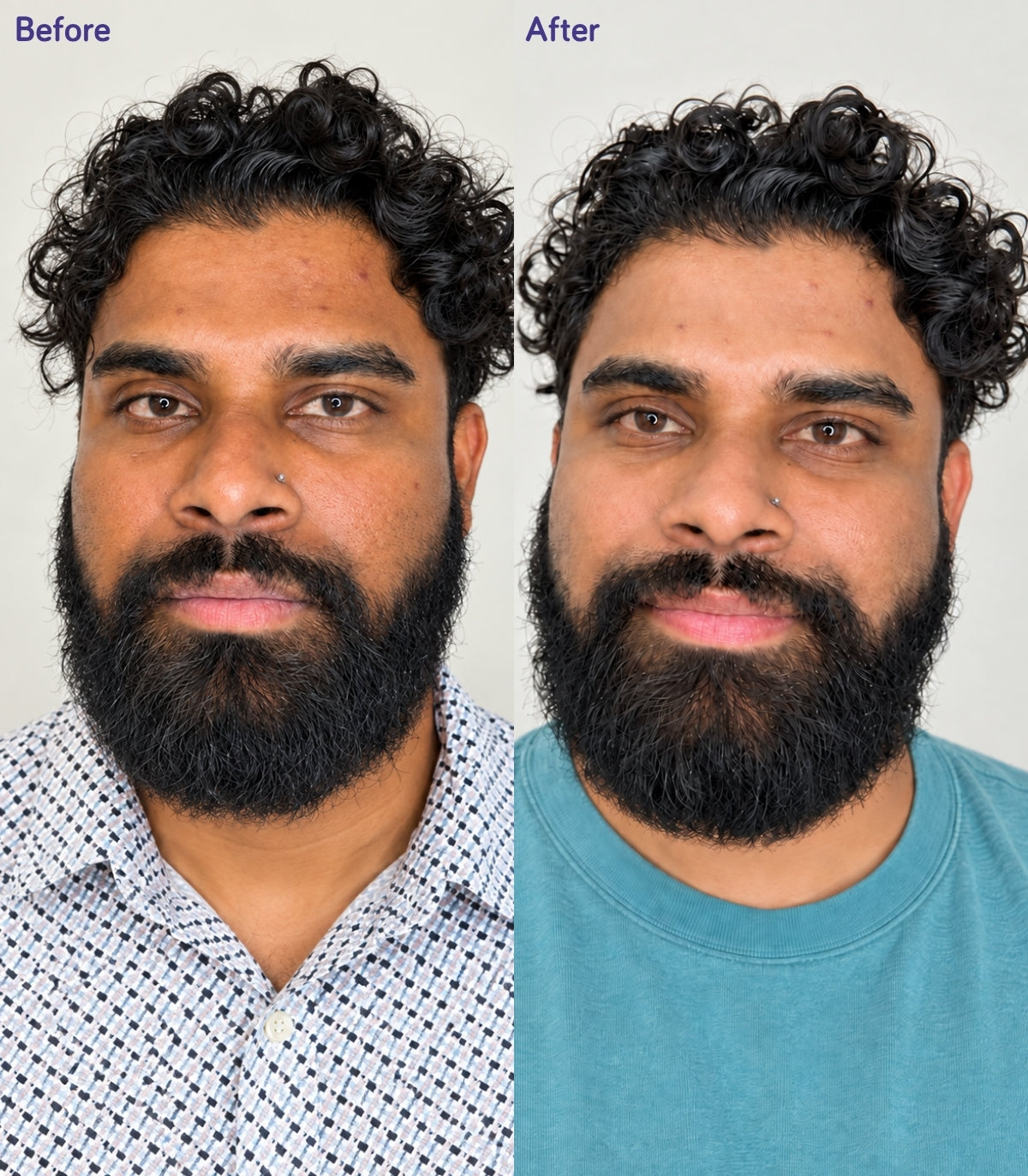 Before and After Results